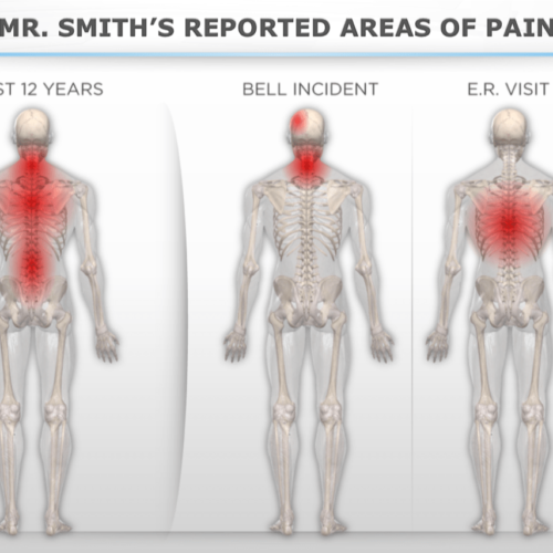 Areas of Pain