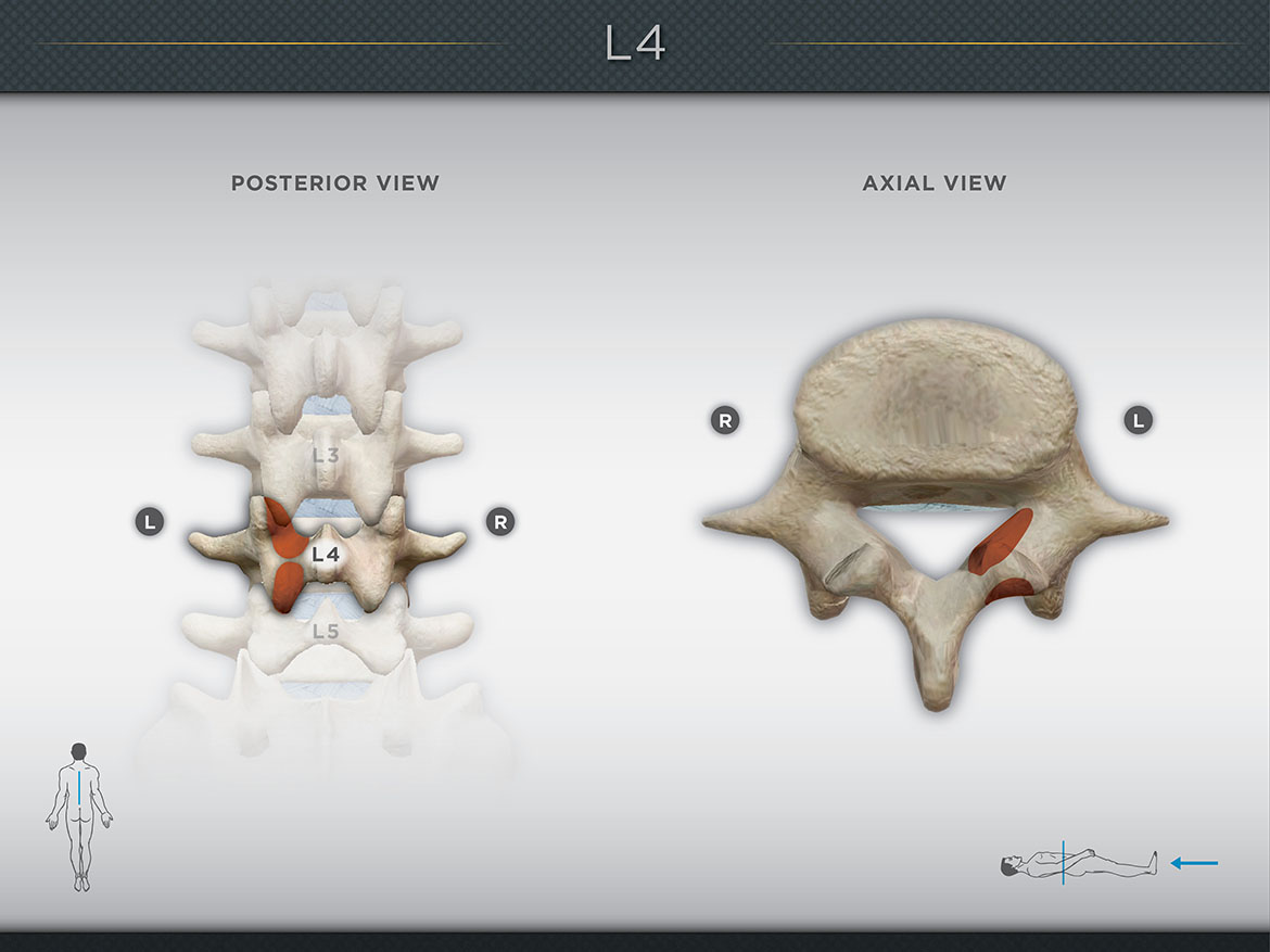 l3 4 and 5 vertebrae