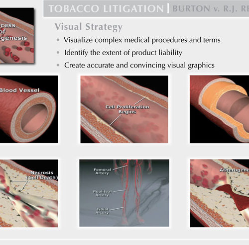 Tobacco Litigation